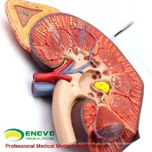 KIDNEY01 (12430) Vergrößern Medizin Anatomie der menschlichen Organe Anatomy Adrenal Gland